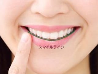 盛岡(盛岡市)の歯医者、医療法人啓仁会 栃内歯科医院の審美歯科治療