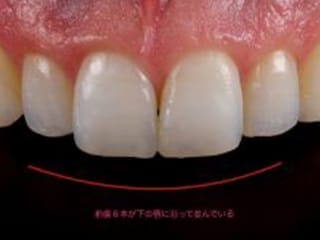 盛岡(盛岡市)の歯医者、医療法人啓仁会 栃内歯科医院の審美歯科治療