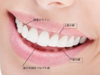 盛岡(盛岡市)の歯医者、医療法人啓仁会 栃内歯科医院の審美歯科治療