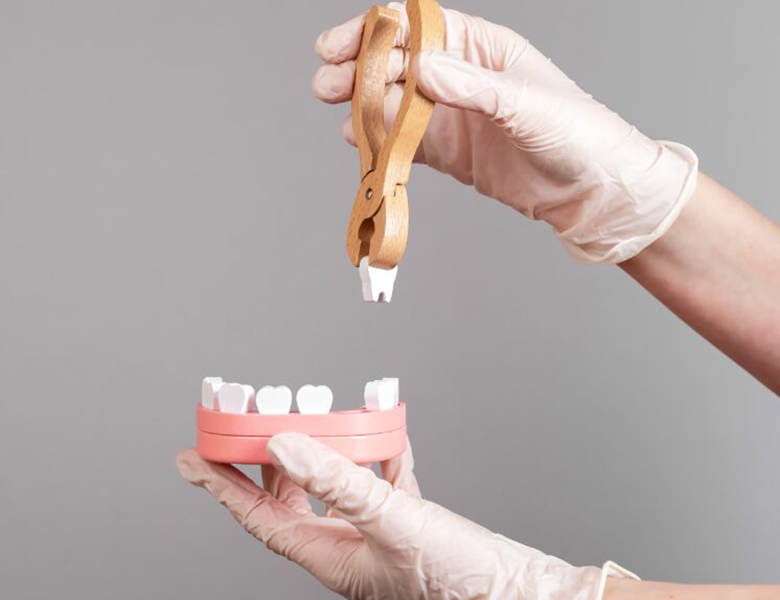 盛岡（盛岡市）の歯医者、医療法人啓仁会 栃内歯科医院のマウスピース矯正（アライナー矯正）