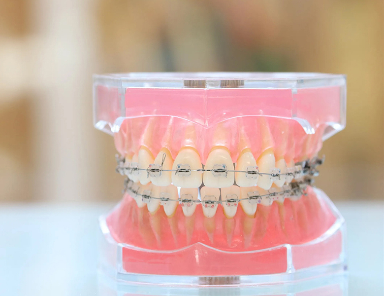 矯正歯科 - 盛岡（盛岡市）の歯医者、医療法人啓仁会 栃内歯科医院