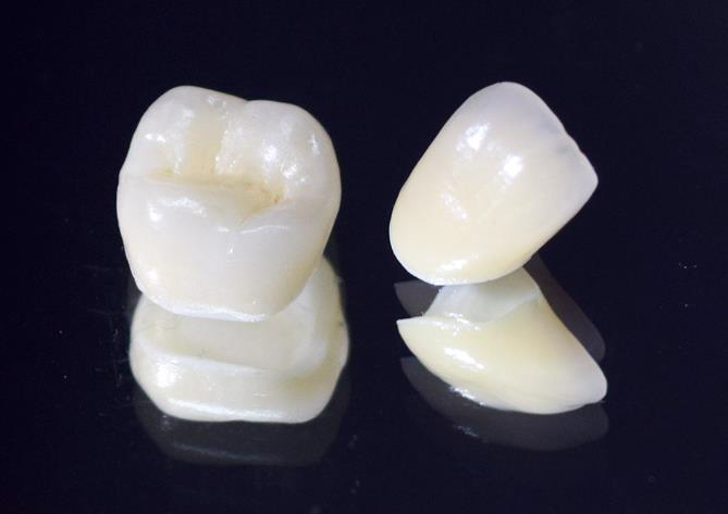 ジルコニアセラミック - 盛岡（盛岡市）の歯医者、医療法人啓仁会 栃内