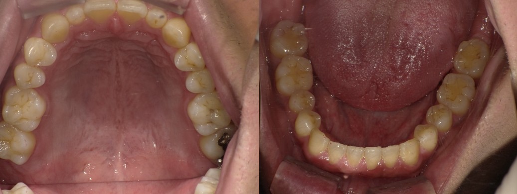 盛岡（盛岡市）の歯医者、医療法人啓仁会 栃内歯科医院の矯正歯科症例